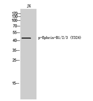 Ephrin-B1/2/3 (phospho-Tyr324) antibody