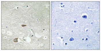CDHF10 rabbit pAb Antibody