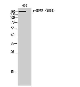 EGFR (phospho Tyr869) rabbit pAb