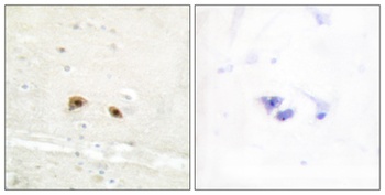 Egr-3 antibody