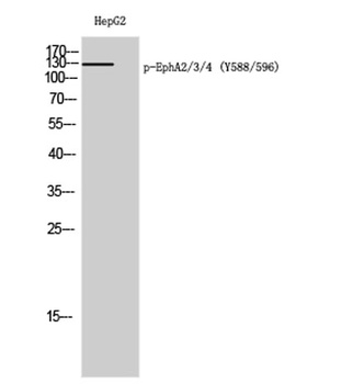 EphA2/3/4 (phospho-Tyr588/596) antibody