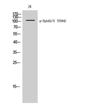 EphA2/5 (phospho-Tyr594) antibody