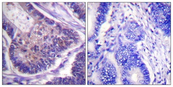 eIF4B rabbit pAb Antibody
