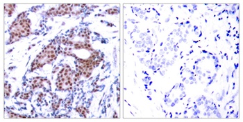 Elk-1 (phospho Ser383) rabbit pAb