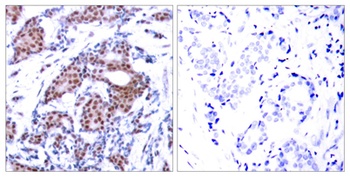 Elk-1 (phospho-Ser383) antibody