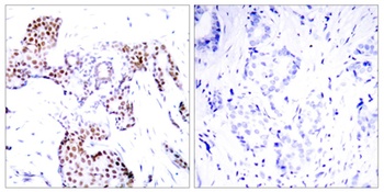 Elk-1 (phospho Ser389) rabbit pAb