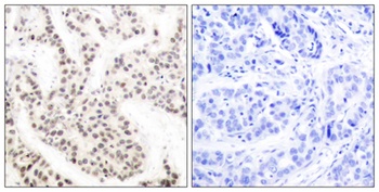 Elk-1 (phospho Thr417) rabbit pAb