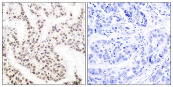 Elk-1 (phospho-Thr417) antibody