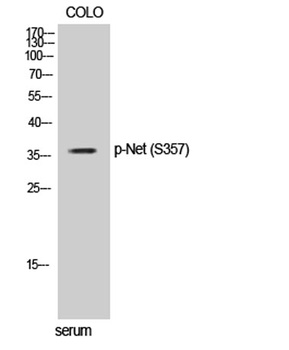 Net (phospho-Ser357) antibody