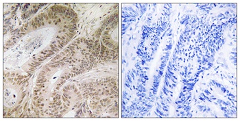 RDM1 antibody