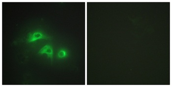 AK1 antibody