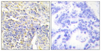 AK1 rabbit pAb Antibody