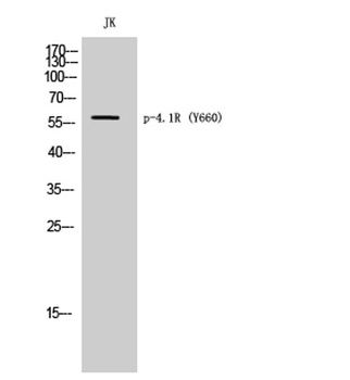 4.1R (phospho Tyr660) rabbit pAb