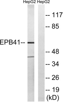 4.1R antibody