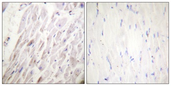 Dematin (phospho Ser403) rabbit pAb