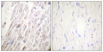 Dematin (phospho-Ser403) antibody