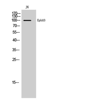 EphA3 rabbit pAb Antibody