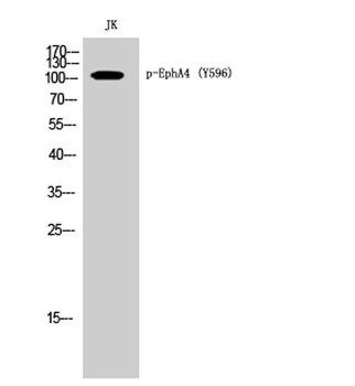 EphA4 (phospho Tyr596) rabbit pAb
