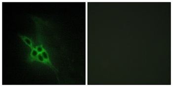 EphB1/2/3 antibody