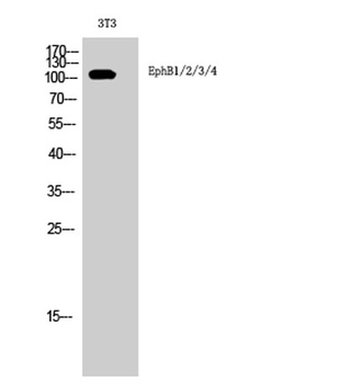 EphB1/2/3/4 antibody
