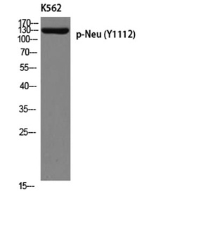 Neu (phospho Tyr1112) rabbit pAb
