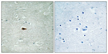 ErbB-3 (phospho-Tyr1328) antibody