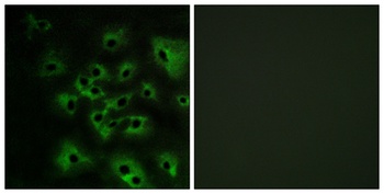 ErbB-4 (phospho Tyr1284) rabbit pAb