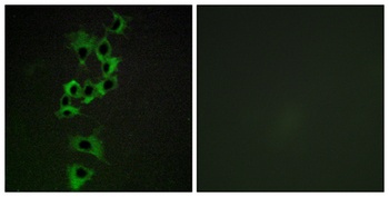ErbB-4 rabbit pAb