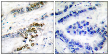 ERCC1 rabbit pAb Antibody