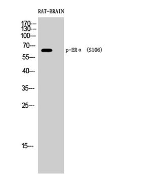 ER alpha (phospho-Ser106) antibody