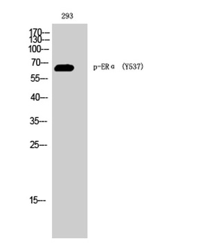 ER alpha (phospho-Tyr537) antibody