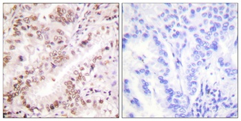 ERα (phospho Tyr537) rabbit pAb Antibody