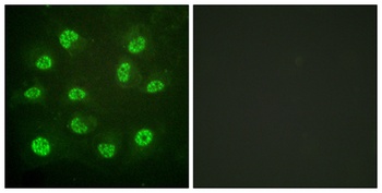 ERβ (phospho Ser105) rabbit pAb Antibody