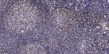 ER beta (phospho-Ser87) antibody