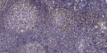 ERβ (phospho Ser87) rabbit pAb