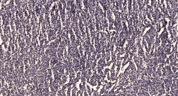 Ets-1 (phospho-Ser251) antibody