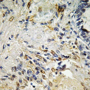 ETS1 rabbit pAb Antibody