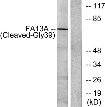 Cleaved-Factor XIIIa (G39) rabbit pAb