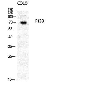 Factor XIII B antibody