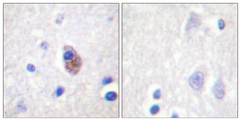 PYK2 (phospho Tyr881) rabbit pAb Antibody