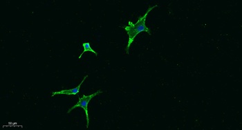 Seprase antibody