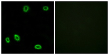 Olfactory receptor 5L1/2 rabbit pAb Antibody