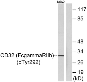 CD32 (phospho Tyr292) rabbit pAb Antibody