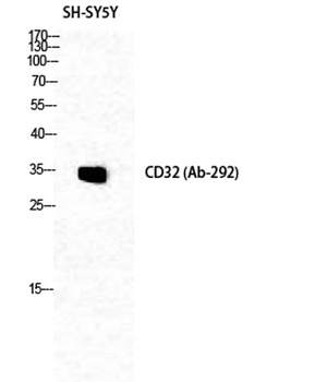 CD32 rabbit pAb