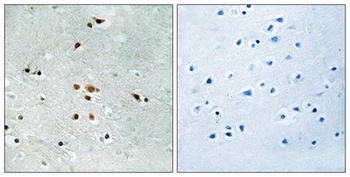 Fer (phospho-Tyr402) antibody