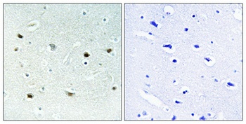 ERK 8 (phospho Thr175/Y177) rabbit pAb Antibody
