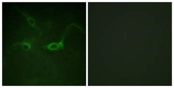 Flg (phospho Tyr654) rabbit pAb Antibody