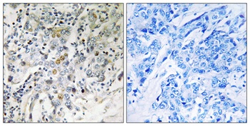 ELL2 antibody