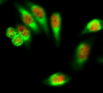 FoxO1 rabbit pAb Antibody