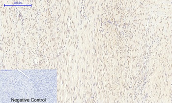 FoxO1 rabbit pAb Antibody